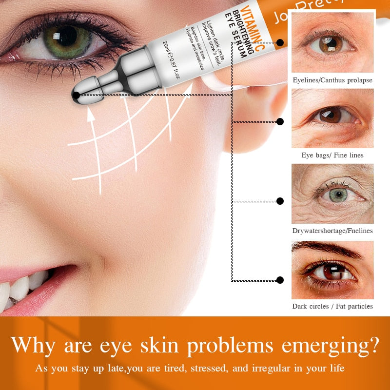 Vitamin C Under Eye Cream for Dark Circles and Eye Bags